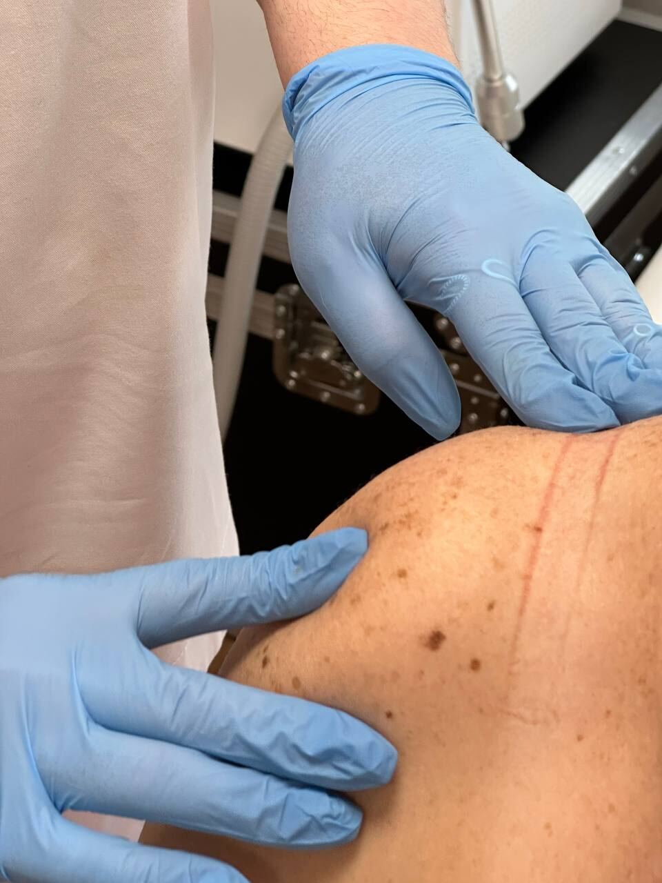 Руки врача в перчатках на спине пациента